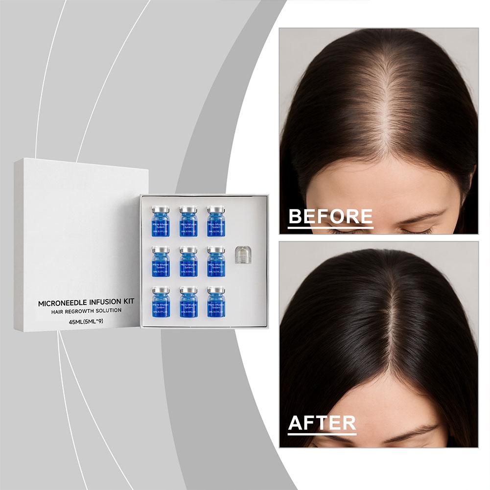 Derma Roller 0.25 - Set di Micro-Aghi con Siero Essenziale