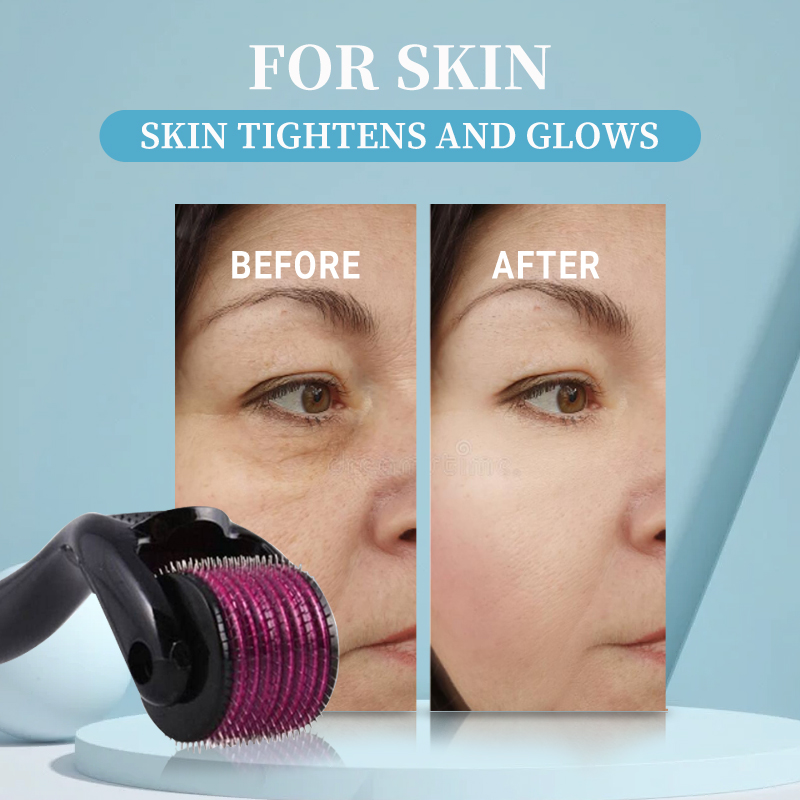 Professionale 540 Roller Derma - Derma Roller 0.25 recensione e prezzo