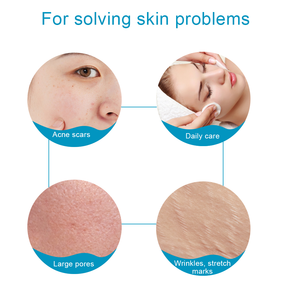 1 pz Rullo Derma in Titanio 54 - Derma Roller 0.25 recensione e prezzo